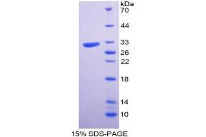 Image no. 1 for Discoidin Domain Receptor tyrosine Kinase 2 (DDR2) (AA 578-817) protein (His tag) (ABIN6237840) (DDR2 Protein (AA 578-817) (His tag))