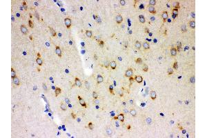 Anti- SSH3BP1 Picoband antibody, IHC(P) IHC(P): Rat Brain Tissue (ABI1 抗体  (N-Term))