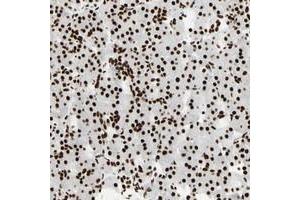 Immunohistochemical staining of human pancreas with CCAR1 polyclonal antibody  shows strong nuclear positivity in exocrine glandular cells. (CCAR1 抗体)