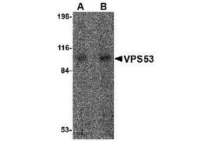 Image no. 1 for anti-Vacuolar Protein Sorting 53 Homolog (VPS53) (Internal Region) antibody (ABIN1493800)