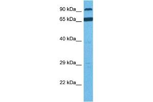 Host:  Rabbit  Target Name:  RHBDF1  Sample Tissue:  Human PANC1 Whole Cell  Antibody Dilution:  1ug/ml (RHBDF1 抗体  (N-Term))