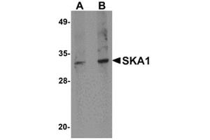 Western blot analysis of SKA1 in A549 cell lysate with SKA1 antibody at 0. (SKA1 抗体  (C-Term))
