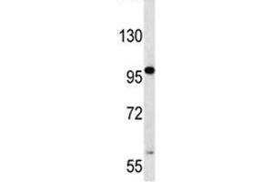 RNF43 antibody western blot analysis in CEM lysate. (RNF43 抗体  (AA 543-572))