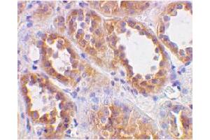 Immunohistochemical staining of human kidney cellsusing ACE2 polyclonal antibody  at 2 ug/mL . (ACE2 抗体  (N-Term))