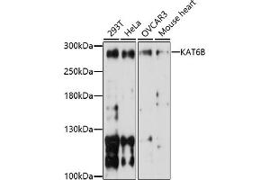 Western blot analysis of extracts of various cell lines, using KB antibody (ABIN7268062) at 1:1000 dilution. (KAT6B 抗体  (AA 400-500))
