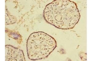 Immunohistochemistry of paraffin-embedded human placenta tissue using ABIN7170360 at dilution of 1:100 (SNX16 抗体  (AA 1-342))