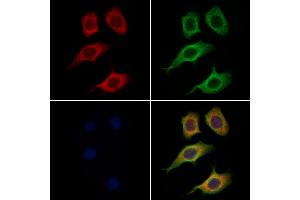 ABIN6265828 and ABIN6269033 staining Hela cells by IF/ICC. (TYR 抗体  (C-Term))