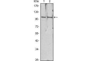 Western blot analysis using HDAC4 mouse mAb against Hela (1), Jurkat (2) cell lysate. (HDAC4 抗体)