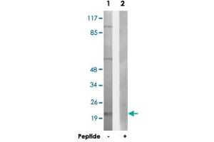 Western blot analysis of extracts from HepG2 cells, using LTB polyclonal antibody . (LTB 抗体  (C-Term))