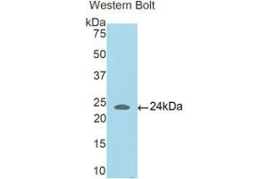 Western blot analysis of the recombinant protein. (CCDC80 抗体  (AA 81-258))
