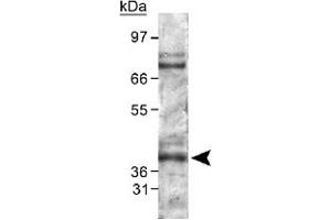 Western blot analysis of PHD2 in mouse kidney lysate using Egln1 polyclonal antibody . (EGLN1 抗体  (AA 300-400))