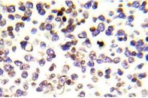 Immunohistochemistry (IHC) analyzes of Histone H2A. (H2AFX 抗体)