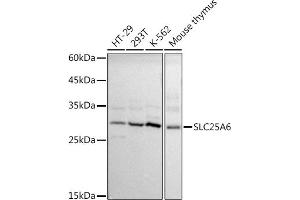 Western blot analysis of extracts of various cell lines, using SLC25 antibody (ABIN1682768, ABIN3017839, ABIN3017840 and ABIN6220286) at 1:1000 dilution.
