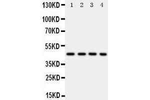 Anti-PDK2 antibody, Western blotting Lane 1: Rat Heart Tissue Lysate Lane 2: HELA Cell Lysate Lane 3: SW620 Cell Lysate Lane 4: MCF-7 Cell Lysate (PDK2 抗体  (C-Term))
