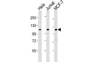 All lanes : Anti-EXOC4 Antibody (N-term) at 1:2000 dilution Lane 1: Hela whole cell lysates Lane 2: Jurkat whole cell lysates Lane 3: MCF-7 whole cell lysates Lysates/proteins at 20 μg per lane. (Sec8 抗体  (N-Term))