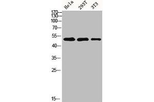 Western blot analysis of HELA 293T 3T3 lysis using MMP-1 antibody.