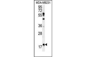 Western blot analysis of RHEB Antibody (C-term) in MDA-MB231 cell line lysates (35ug/lane).