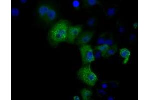 Anti-DCXR mouse monoclonal antibody (ABIN2452945) immunofluorescent staining of COS7 cells transiently transfected by pCMV6-ENTRY DCXR (RC200023). (DCXR 抗体)