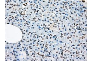 Immunohistochemical staining of paraffin-embedded colon tissue using anti-XRCC4mouse monoclonal antibody. (LTA4H 抗体)