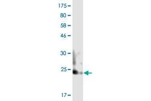 Western Blot detection against Immunogen (21.