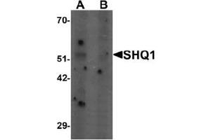 Western blot analysis of SHQ1 in human heart tissue lysate with SHQ1 Antibody  at 1 ug/mL in (A) the absence and (B) the presence of blocking peptide. (SHQ1 抗体  (N-Term))