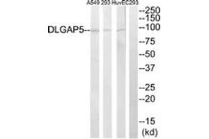 Western blot analysis of extracts from A549/293/HuvEc cells, using DLGAP5 Antibody. (DLGAP5 抗体  (AA 791-840))