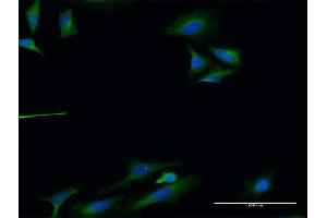 Immunofluorescence of monoclonal antibody to TLN1 on HeLa cell. (TLN1 抗体  (AA 1324-1424))