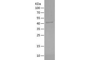 PSMB9 Protein (AA 21-219) (His-IF2DI Tag)