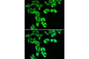 Immunofluorescence analysis of HeLa cells using STRN3 antibody (ABIN6129134, ABIN6148646, ABIN6148648 and ABIN6222490). (STRN3 抗体  (AA 200-460))