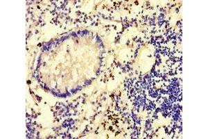 Immunohistochemistry of paraffin-embedded human appendix tissue using ABIN7149462 at dilution of 1:100