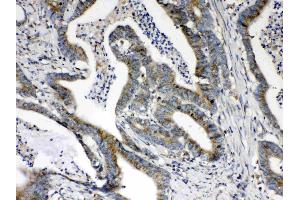 Immunohistochemistry (IHC) image for anti-Hydroxysteroid (17-Beta) Dehydrogenase 4 (HSD17B4) (AA 510-736) antibody (ABIN5518845)