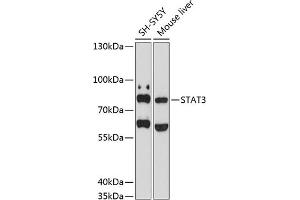 Western Blotting (WB) image for anti-Signal Transducer and Activator of Transcription 3 (Acute-Phase Response Factor) (STAT3) (AA 40-240) antibody (ABIN6148567)