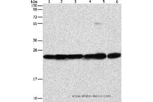 Western blot analysis of Mouse liver and brain tissue, 293T, A549, A431 and PC3 cell, using SIGMAR1 Polyclonal Antibody at dilution of 1:310 (SIGMAR1 抗体)