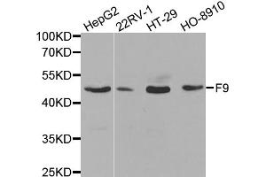 Western blot analysis of extracts of various cell lines, using F9 antibody (ABIN5970759) at 1/1000 dilution. (Coagulation Factor IX 抗体)