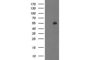 Western Blotting (WB) image for anti-Pre-B-Cell Leukemia Homeobox Protein 1 (PBX1) antibody (ABIN1500045) (PBX1 抗体)