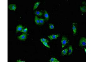 Immunofluorescent analysis of HepG2 cells using ABIN7142627 at dilution of 1:100 and Alexa Fluor 488-congugated AffiniPure Goat Anti-Rabbit IgG(H+L) (Serotonin Receptor 3A 抗体  (AA 322-455))