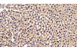 Immunohistochemistry (IHC) image for anti-Sequestosome 1 (SQSTM1) (AA 136-400) antibody (ABIN7435412)