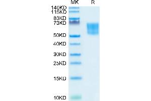 Biotinylated Human TPBG/5T4 on Tris-Bis PAGE under reduced condition. (TPBG Protein (AA 32-355) (His-Avi Tag,Biotin))