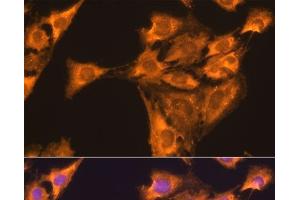 Immunofluorescence analysis of C6 cells using RPL23 Polyclonal Antibody at dilution of 1:100. (RPL23 抗体)