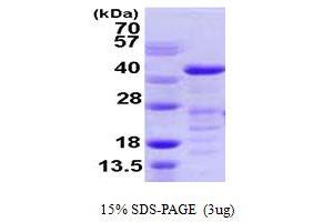 Vasodilator-Stimulated phosphoprotein (VASP) (AA 1-343) protein (His tag)