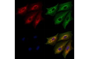 ABIN6264233 and ABIN6279658 staining  cells by IF/ICC. (PITPNA 抗体  (Internal Region))