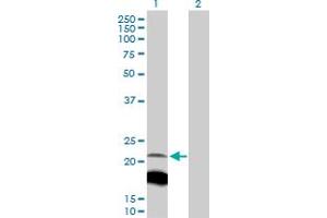 Western Blot analysis of IGLL1 expression in transfected 293T cell line by IGLL1 MaxPab polyclonal antibody. (IGLL1 抗体  (AA 1-213))