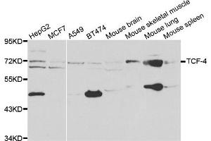 Western blot analysis of extracts of various cell lines, using TCF4 antibody. (TCF4 抗体)