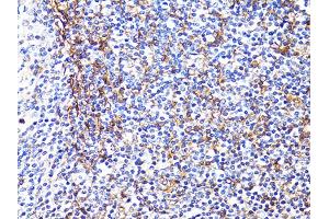Immunohistochemistry of paraffin-embedded human tonsil using S100A10 antibody (ABIN5971035) at dilution of 1/100 (40x lens). (S100A10 抗体)
