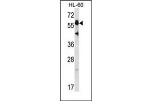 Western blot analysis of Heat shock factor 4 / HSF4 (N-term) Antibody (N-term) in HL-60 cell line lysates (35ug/lane). (HSF4 抗体  (N-Term))