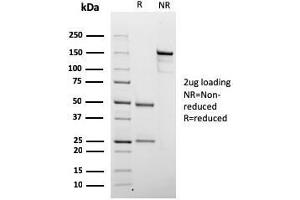 SDS-PAGE Analysis Purified Chromogranin A Mouse Recombinant Monoclonal Ab (rCHGA/798). (Recombinant Chromogranin A 抗体)