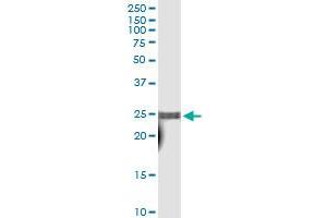 Immunoprecipitation (IP) image for anti-TAF10 RNA Polymerase II, TATA Box Binding Protein (TBP)-Associated Factor, 30kDa (TAF10) (AA 1-218) antibody (ABIN520673)