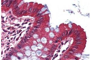 Immunohistochemistry (Formalin/PFA-fixed paraffin-embedded sections) of human colon tissue with KCNA3 polyclonal antibody .