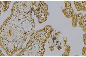 ABIN6279235 at 1/100 staining Mouse placenta tissue by IHC-P. (Calpain 6 抗体  (Internal Region))
