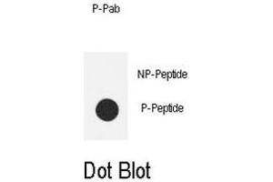 Dot blot analysis of anti-Phospho-eNos-S1177 Phospho-specific Pab on nitrocellulose membrane. (ENOS 抗体  (pSer1177))